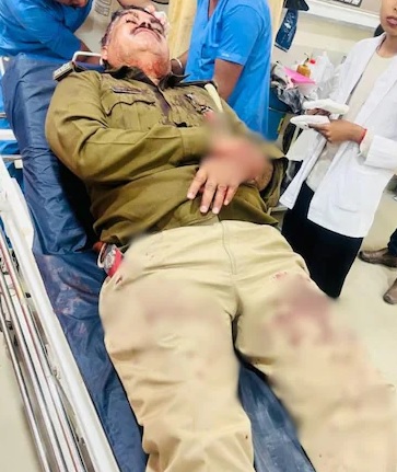 झगड़े की सूचना पर मौके पर पहुंचे पुलिस दल पर जानलेवा हमला झगड़े की सूचना पर मौके पर पहुंचे पुलिस दल पर जानलेवा हमला