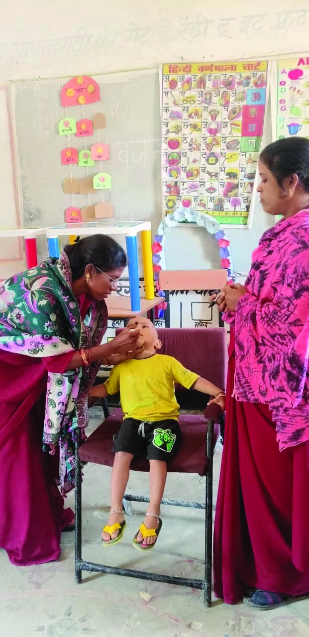 शहरी और ग्रामीण क्षेत्रों में पल्स पोलियो अभियान का सफल क्रियान्वयन शहरी और ग्रामीण क्षेत्रों में पल्स पोलियो अभियान का सफल क्रियान्वयन