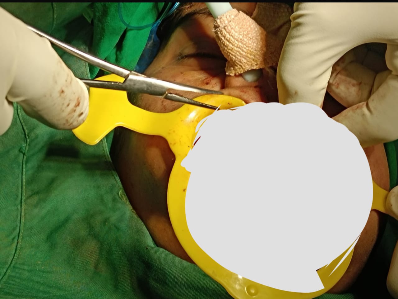 Successful jaw surgery for young women Successful jaw surgery for young women