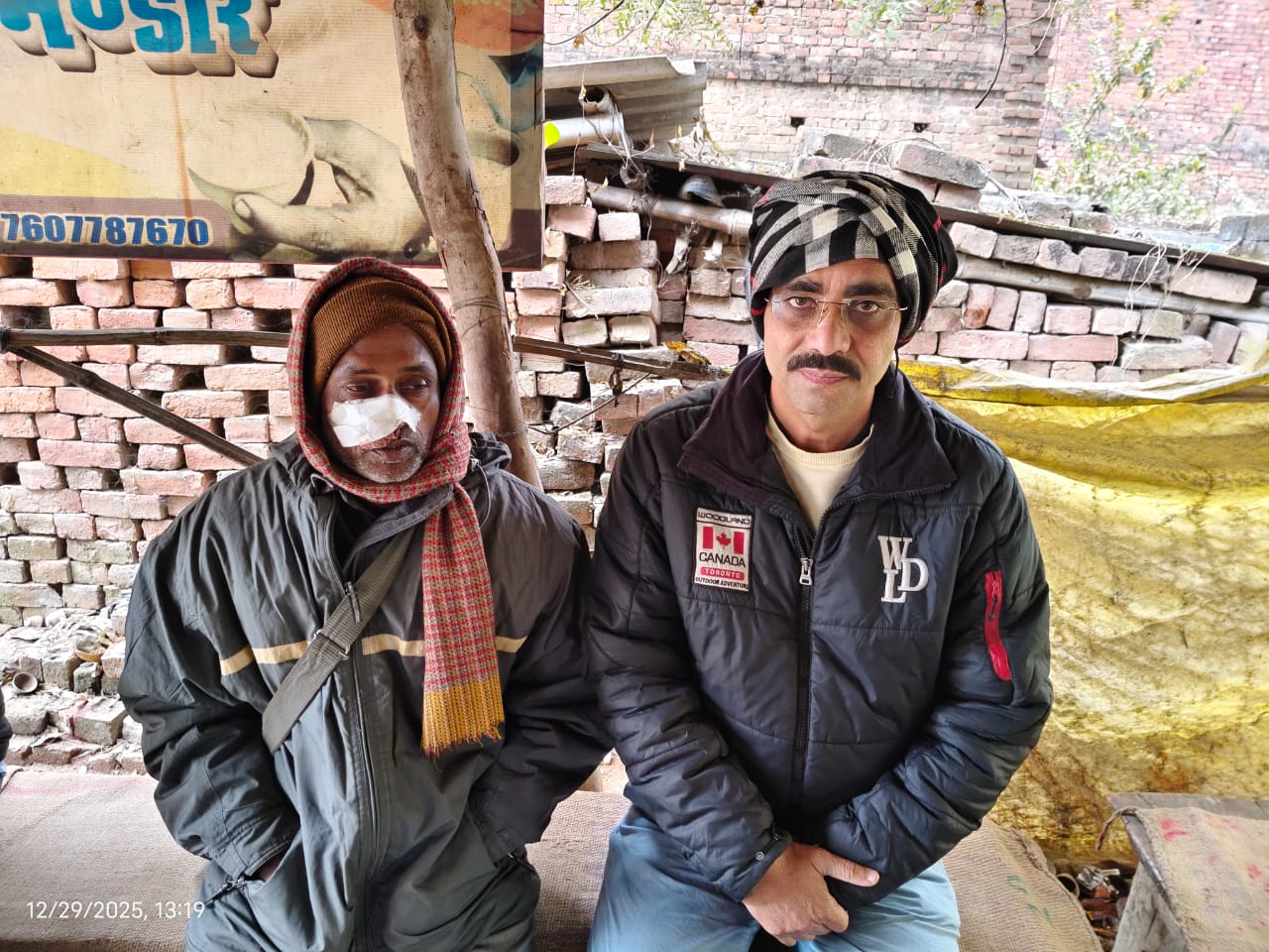 चाइनीज मांझे के चपेट में आने से युवक की कटी नाक चाइनीज मांझे के चपेट में आने से युवक की कटी नाक