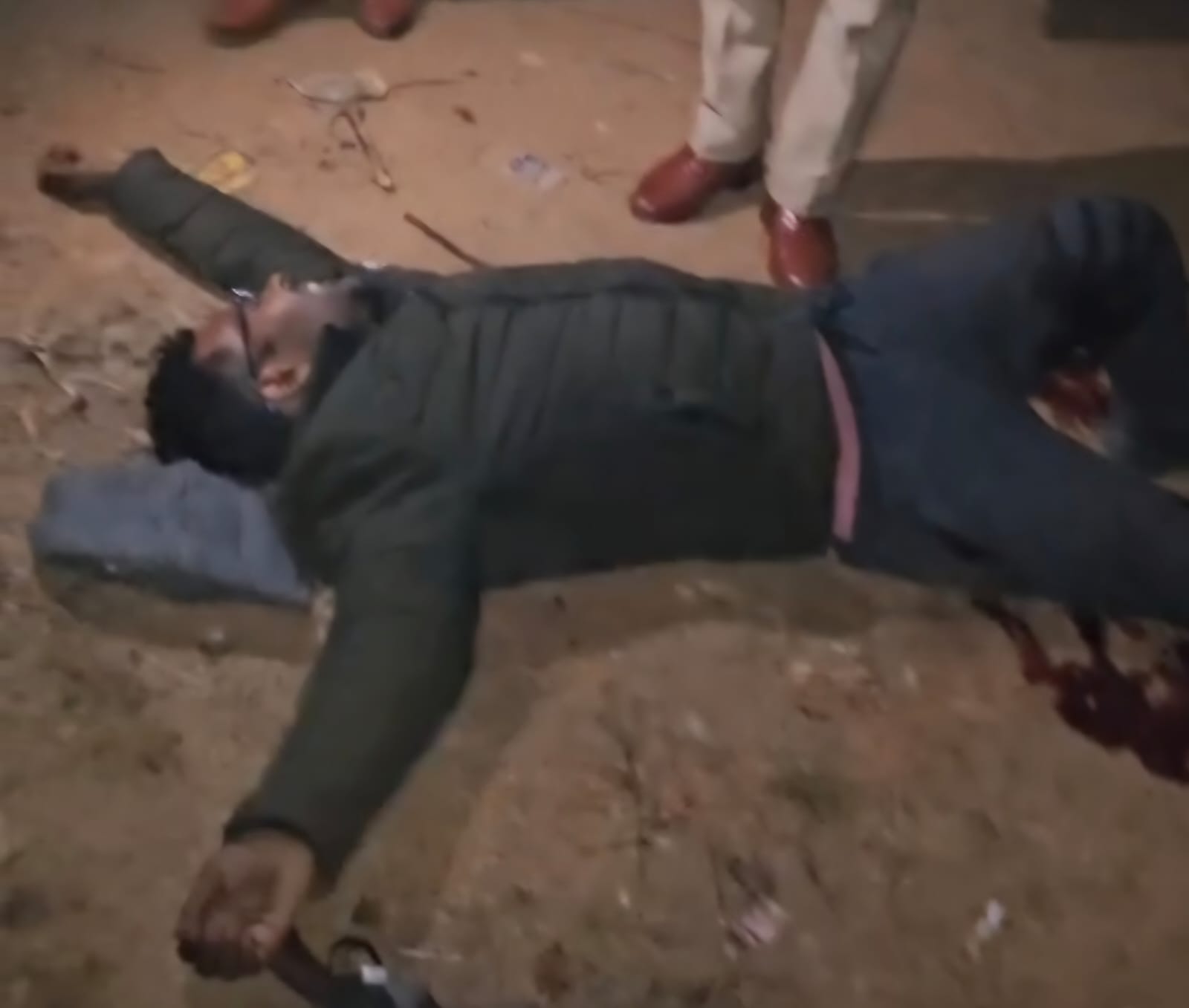 घायल हत्यारोपित