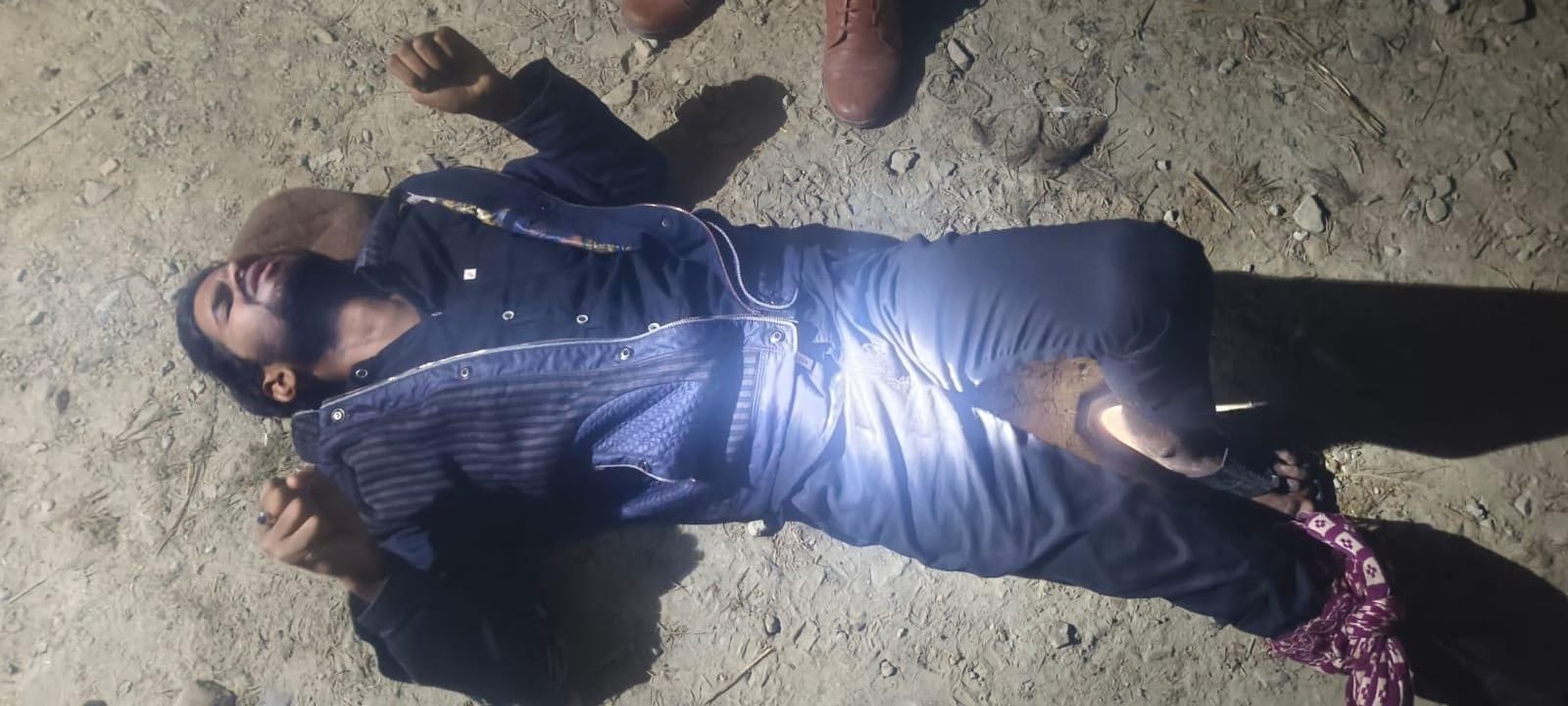 मुठभेड़ में गोली से घायल बदमाश एवं पुलिस टीम की फोटो