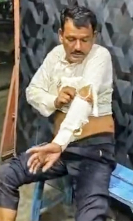 तेंदुए के हमले में घायल ग्रामीण