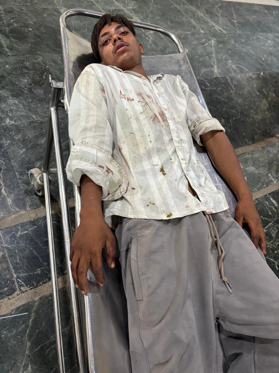 पुलिस की जवाबी कार्रवाई में दो आरोपियों के पैर में गोली लगी