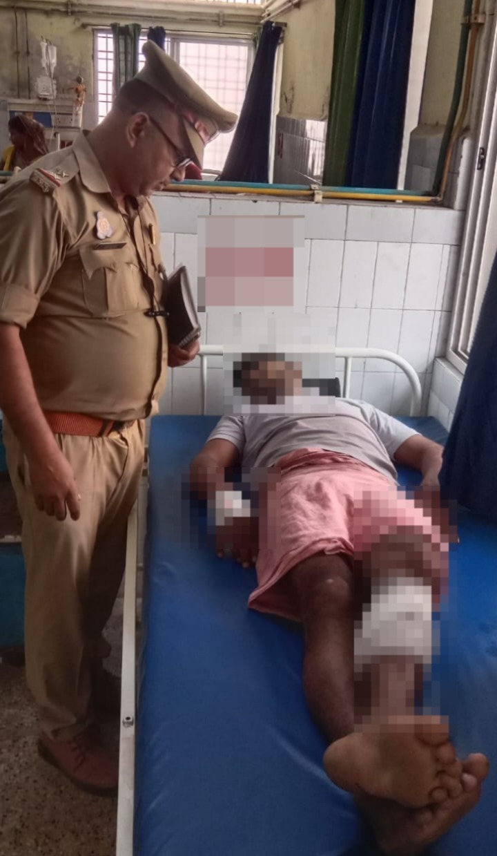 पुलिस मुठभेड़ में घायल अपराधी पुलिस अभिरक्षा में