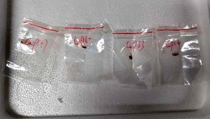 Chinese scientist arrested for trafficking toxic fungus in America Chinese scientist arrested for trafficking toxic fungus in America